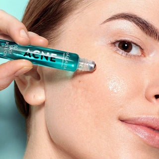 ACNE roller - ontstekingswerend